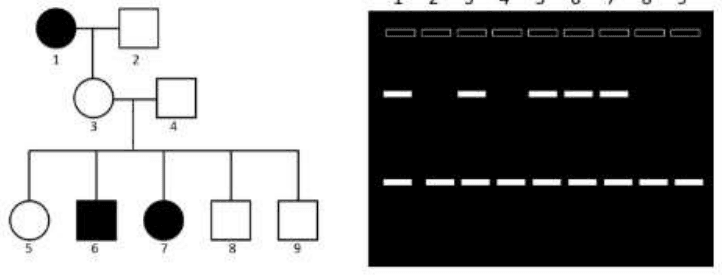 Pedigree of individuals 1 to 9 and DNA marker gel