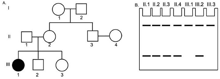 Pedigree of a monogenic disorder and PAGE allozyme pattern for family members