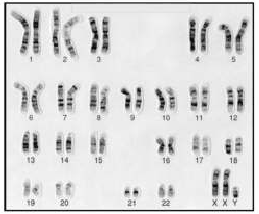 Banded human karyotype with chromosomes 1 to 22, X, X and Y