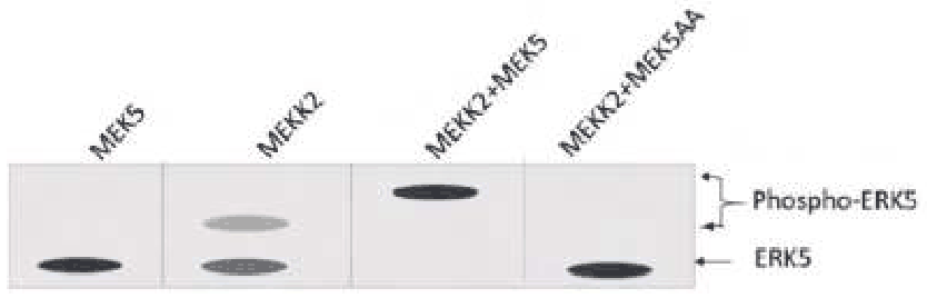Western blot of ERK5 and phospho-ERK5 with MEK5, MEKK2, MEKK2+MEK5 and MEKK2+MEK5AA